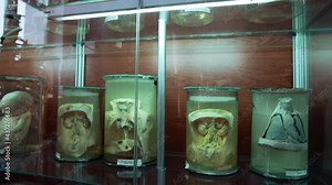 Human in formalin in medical museum. Collection of human organs preserved in large jars with formaldehyde and displayed vertically in museum