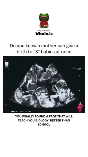 BIOLOGY | MEDICAL | HEALTH on Instagram: "The birth of octuplets, eight babies at once, is a rare occurrence often linked to fertility treatments like IVF. Multiple embryos are transferred to the uterus, and if all implants, it can result in a multiple pregnancy. Close medical monitoring and care are crucial to manage risks and ensure the best outcome for both mother and babies. Dm for credit or removal 👏🏻🙏🏻 For educational purposes only………. #viral #explore #biology #science #knowledge #bio 