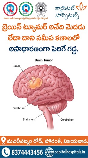 Understanding Brain Tumors | Symptoms, Causes & Treatment Explained | Capital Hospitals Vijayawada