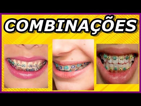 LEARN HOW TO CHOOSE THE BEST COLOR COMBINATIONS FOR YOUR ORTHODONTIC BRACES | DEFINITIVE GUIDE!