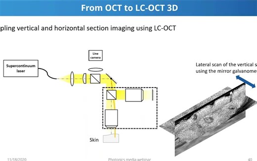 线场共聚焦光学相干断层成像 - Line-field Confocal Optical Coherence Tomography (LC-OCT)