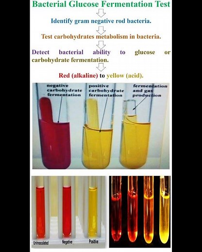 Bacterial Glucose Fermentation Test #geneticteacher