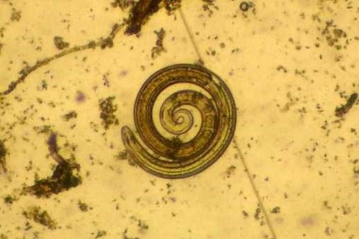 Trichinosis: what it is and how to prevent Trichinella infestation