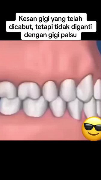 #klinikgigikelantan #klinikgigikoklanas #gigipalsu