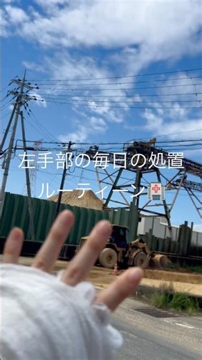 左手部の毎日の処置ルーティーン #消毒 #ルーティーン #火傷