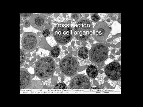Anatomy fovea Stiles-Crawford
