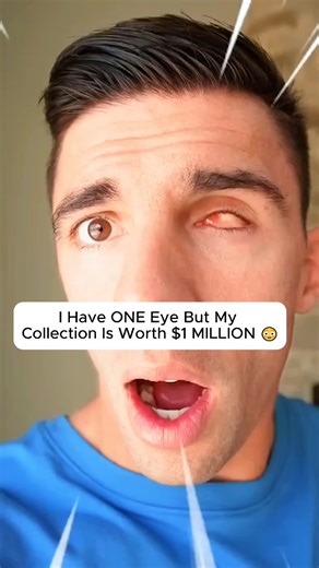 I Have ONE Eye But My Collection Is Worth $1 MILLION 😳 #2026 #millionaire #collection #mystery #shocking