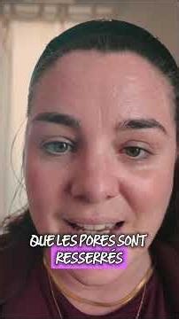 Acne: My New PCOS-Friendly Skincare Routine