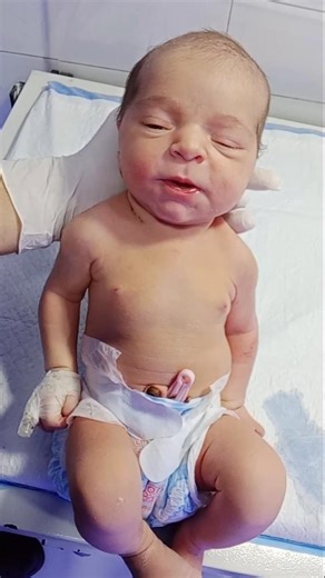 Newborn Baby in NICU | Observation Care & Checking Reflex Moment