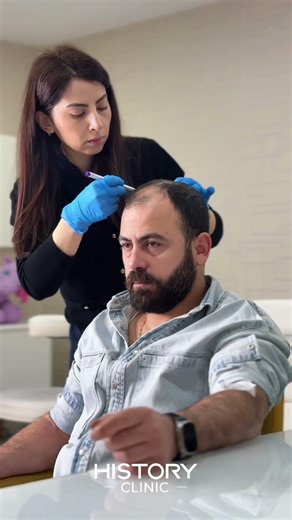 Natural Hairline Design Explained | Real Patients Transformation Planning | Hair Transplant Turkey
