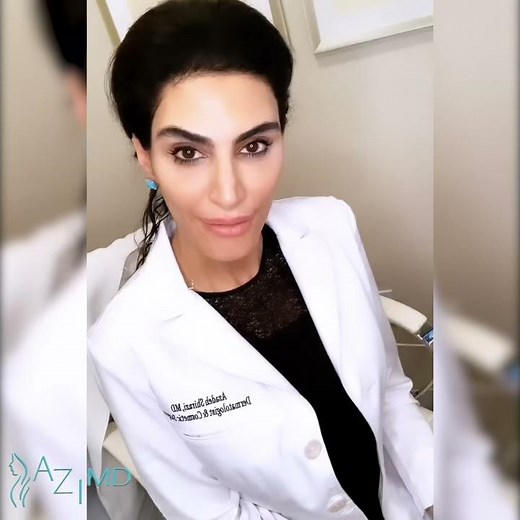 Non-surgical LipLift using dissolvable threads