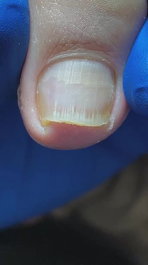 Expert Pedicure Tools for Footcare and Relaxation