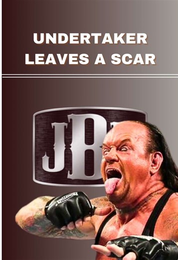 Undertaker causes BOTCH JOB! #undertaker #wwe #stitches #scar #prowrestling