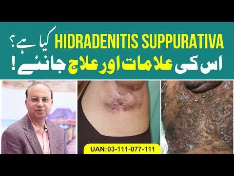 Hidradenitis Suppurativa | Causes, Symptoms & Treatment | Cosmetique