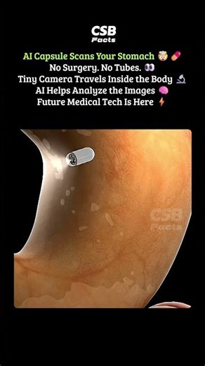 AI Capsule Replaces Endoscopy 🤯💊