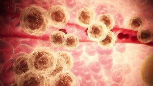 Cancer cells causing metastasis cancerous tumor - 3D animation render