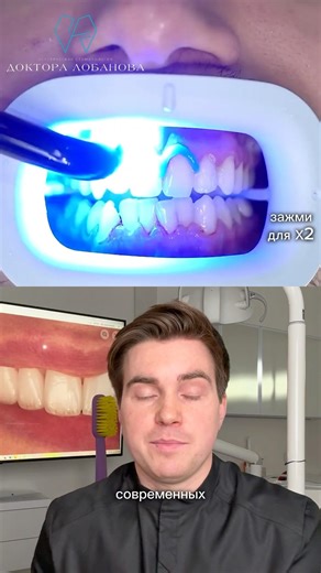 А вы знали, что современное отбеливание зубов полезно для эмали?