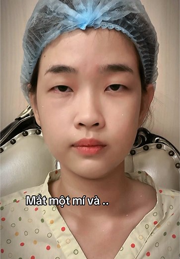 #catmi giúp đôi mắt trẻ trung hơn #drdoanlam #lamdep #pttm #dcgr