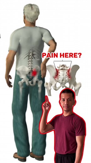 S.I Joint mobility! - Sacroiliitis is a painful condition that affects one or both sacroiliac joints. These joints sit where the lower spine and pelvis meet. Sacroiliitis can cause pain and stiffness in the buttocks or lower back, and the pain might go down one or both legs. - #sijoint #sijointdysfunction #sijointpain #Sacroilitis #backpain #backpainrelief #Buttocks #buttockspain #foryoupage #foryou #fypシ #physicaltherapysession #physicaltherapy #physio #physiotherapy #painrelief | Physical Ther