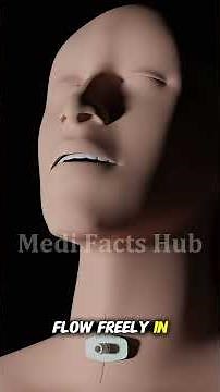 How Doctors Create a New Airway to Save Lives 😱 | Tracheotomy 3D Explained #Shorts