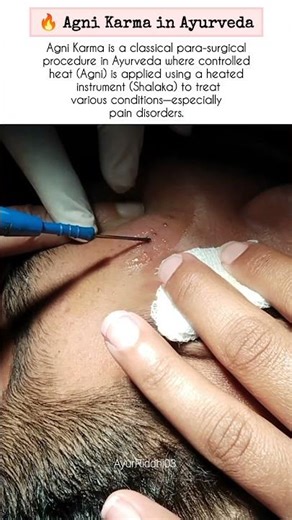 Agni karm!#ayurveda #helthbenefits