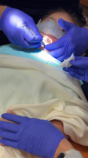 Diane's Dental Filling: A Look at the Procedure 💛💙