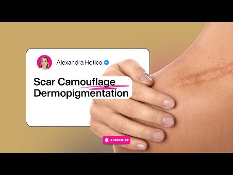 Scar Camouflage through Dermopigmentation | What it is and how it can help you