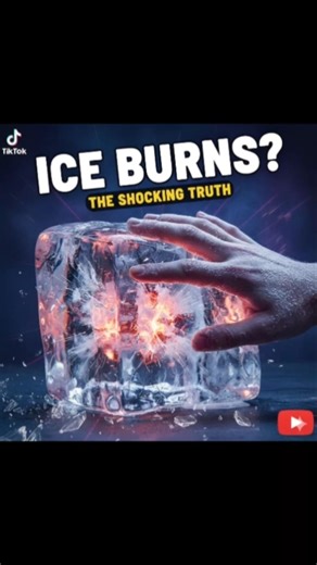 Did You Know Cold Can Feel Like Burning?