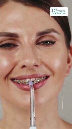 How to use a water flosser? | Water Flossing is easy | Oral Health Care | Dr. Parinda's Clinic