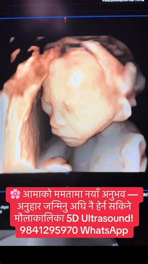 5D Ultrasound: बच्चाको अनुहार जन्मभन्दा पहिले देख्नुस्