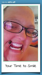 "I've been looking for veneers for quite a while due to to some missing cracked, broken, and discolored teeth.. now look at my smile!" 😳 https://us.instasmile.com/ | instasmile