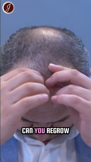 🚀 Regrow Your Hair with Exosome Therapy – No Surgery, No Pain, Just Results! 🌱