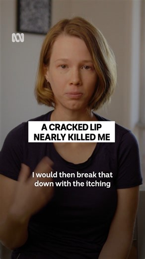 Mathilda’s eczema wasn’t just uncomfortable, it was nearly fatal. But that changed when she finally found the right treatment. | ABC Science