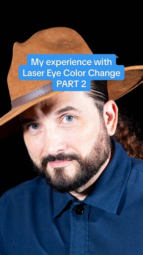 Laser Eye Color Change Experience: Part 2 Insights