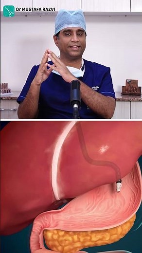 Pseudocyst treatment telugu | Dr Mustafa | #Pseudocyst #pancreas #panpancreatitis #endoscopy