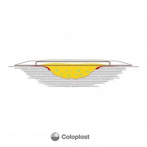 13 reactions · 7 comments | What kinds of symptoms have you...