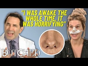 Lauren Was AWAKE During Her Botched Nose Job & Left with Heart-Shaped Cartilage | Botched | E!
