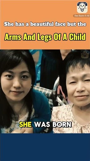 She has a beautiful face but the arms and legs of a child