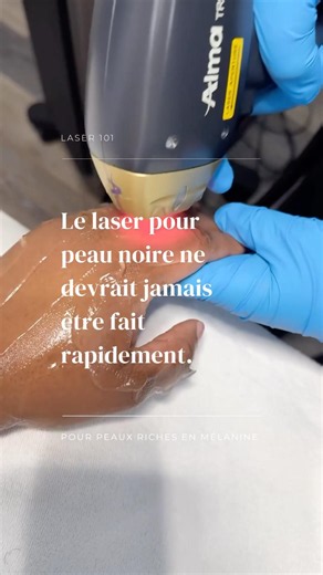 Chaque session d’épilation laser est conçu pour faire un suivi, votre soin et répondre aux questions