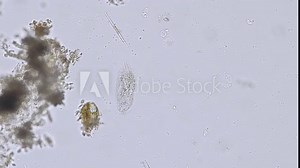 ciliates stylonychia (ciliated protozoan) from a river under the microscope - light microscope x200 magnification