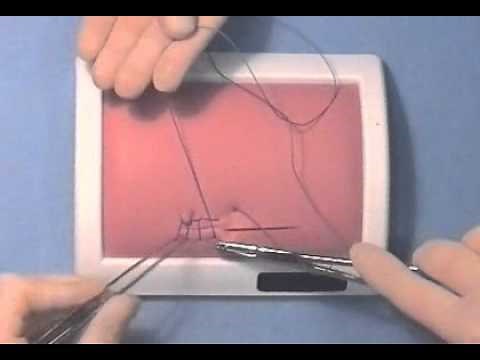 Continuous Locked Suture