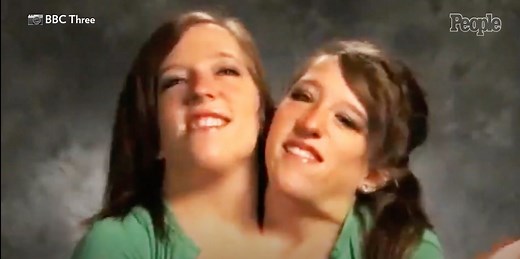 Conjoined Twin Abby Hensel Got Married in a 2021 Wedding Ceremony