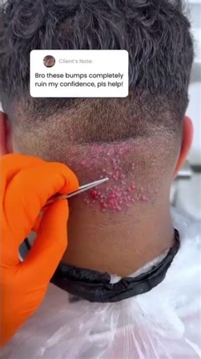 Do you have (AKN) same issue? ‪@RenewdWellbeing‬