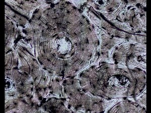 Human Anatomy Chapter 6 Bone Tissue P1