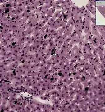 Shotgun Histology Liver Kupffer Cells