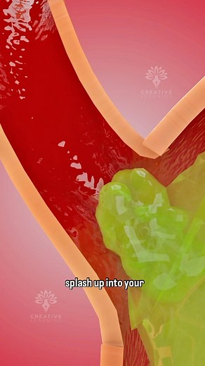 125K views · 866 reactions | #acidreflux #creativelrarning3d #AcidityRelief | Arifkhan3ds | Facebook