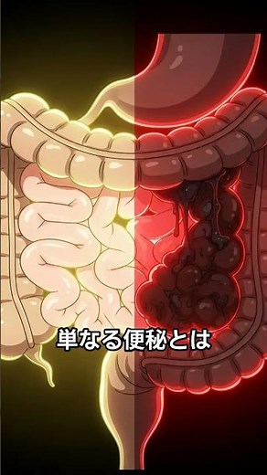 下剤が効かない＋水様便…それ“狭窄”かも｜40代50代は大腸がんを疑うべきサイン