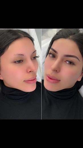 Long-Lasting Eyebrow Solutions: Permanent Brows for 3 Years
