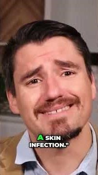 Gross BUT Fascinating: Botfly Larvae Found on Dog! #shorts