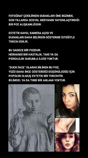 Duck Face Gerçeği! Poz Mu, Alışkanlık Mı? #duckface #poz #sosyalmedya #fotoğraf #estetik #bilgi